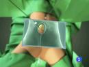 Ir al Video&nbsp;Nueva t&eacute;cnica de trasplante de ri&ntilde;&oacute;n entre vivos para mujeres donantes