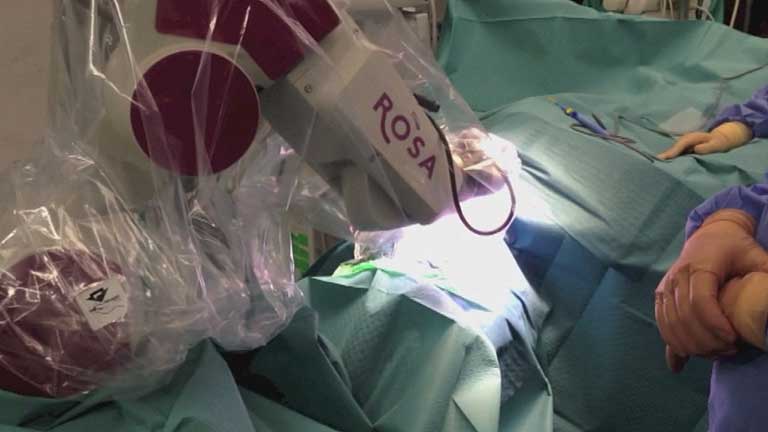 Cirugía robotizada para el cáncer cerebral 