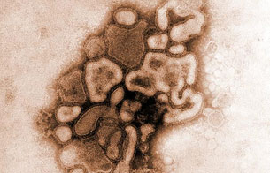 Ver v&iacute;deo  'La OMS advierte de una posible epidemia de peste porcina'
