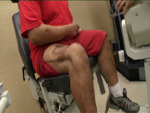 pierna-sin-msculo pierna-sin-msculo