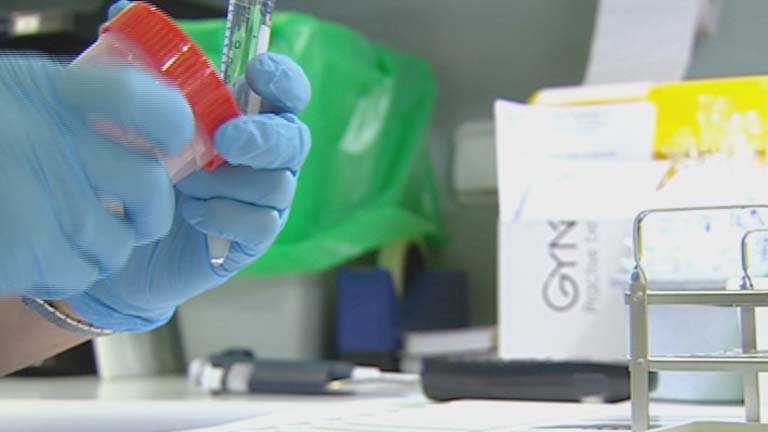 El Consejo Interterritorial de Salud aprueba una prueba para prevenir el cáncer de colon