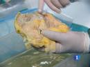 Ir al Video&nbsp;Primer laboratorio del mundo que fabricar&aacute; &oacute;rganos bioartificiales con c&eacute;lulas madre