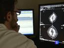 Ir al Video&nbsp;Primer simulador del mundo de cirug&iacute;a virtual de c&aacute;ncer