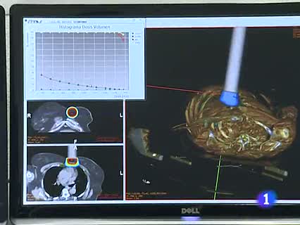 Ver v&iacute;deo  'Primer simulador del mundo de cirug&iacute;a virtual de c&aacute;ncer'