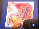Ir al Video&nbsp;Por primera vez en Espa&ntilde;a un menor se somete a una operaci&oacute;n de cambio de sexo