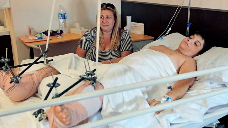 Pedro Cavadas consigue reimplantar a un ni&ntilde;o de 10 a&ntilde;os sus dos pies