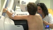 Ir al Video&nbsp;Quitar el pecho como m&eacute;todo para evitar el c&aacute;ncer de mama hereditario
