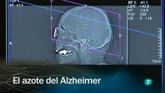 Ver v&iacute;deo  'Redes - El azote del Alzheimer'