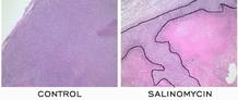 Imagen del efecto del salinomycin en las c&eacute;lulas cancer&iacute;genas.