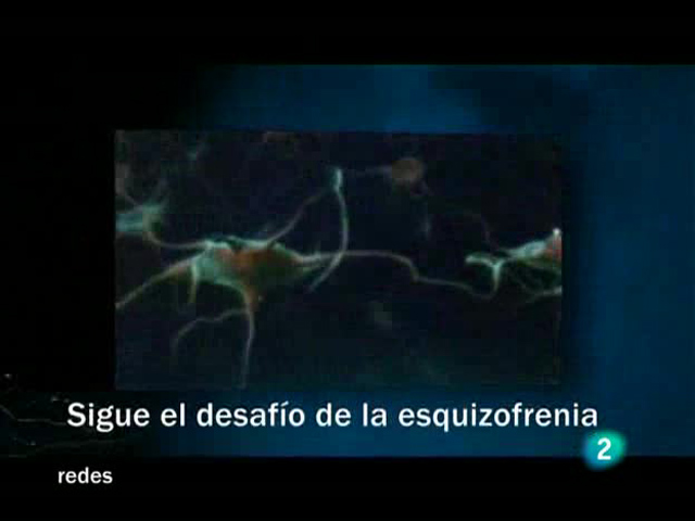 Redes - Sigue el desafío de la esquiofrenia