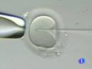 Ir al Video&nbsp;Simulador que ense&ntilde;a como insertar un espermatoziode dentro del &oacute;vulo