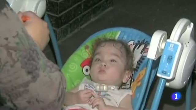 Una tr&aacute;quea hecha con una impresora 3D salva la vida de un beb&eacute;