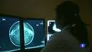 Ir al Video&nbsp;Tratamiento preventivo contra el c&aacute;ncer de mama en Reino Unido