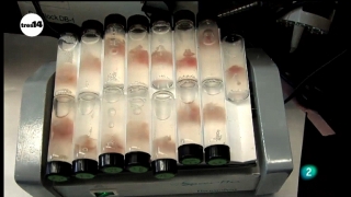 Ver v&iacute;deo  'tres14 - C&eacute;lulas madre'