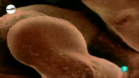 Ver v&iacute;deo  'tres14 - Curiosidades cient&iacute;ficas - Los beb&eacute;s tienen m&aacute;s huesos que los adultos'