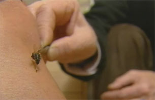 Ver v&iacute;deo  'El veneno de las abejas tiene propiedades curativas'